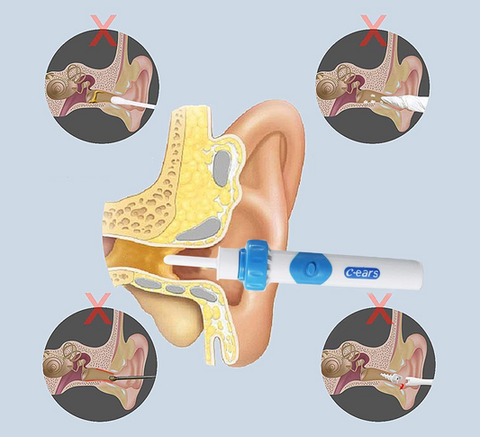 C-EARS elektromos fültisztító készülék + tok és kefe